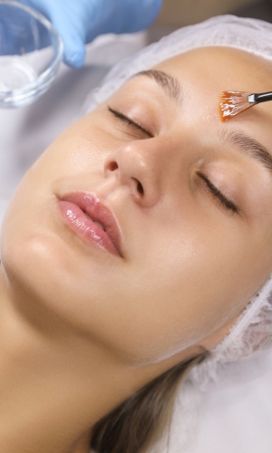 chemical peels Lakewood co