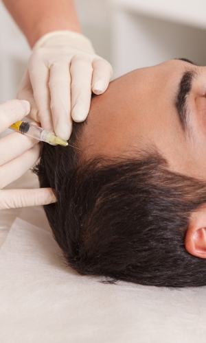denver hair loss treatments