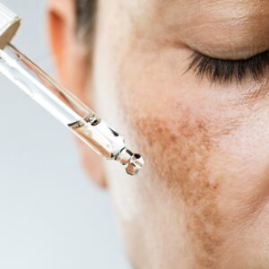Medical Skin Care Treatments in Lakewood & Denver