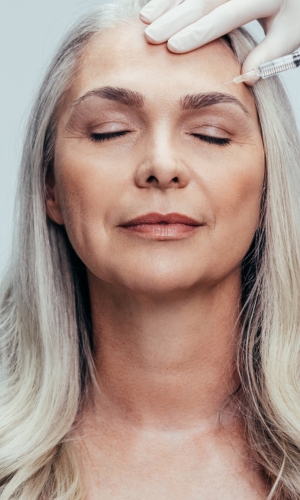 botox treatment
